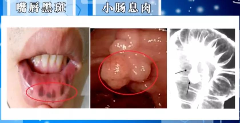 微信圖片_20200813130830.jpg 微信圖片_20200813130830.jpg